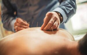 Natural Healing Acupuncture: An Easy Way to Boost Wellness