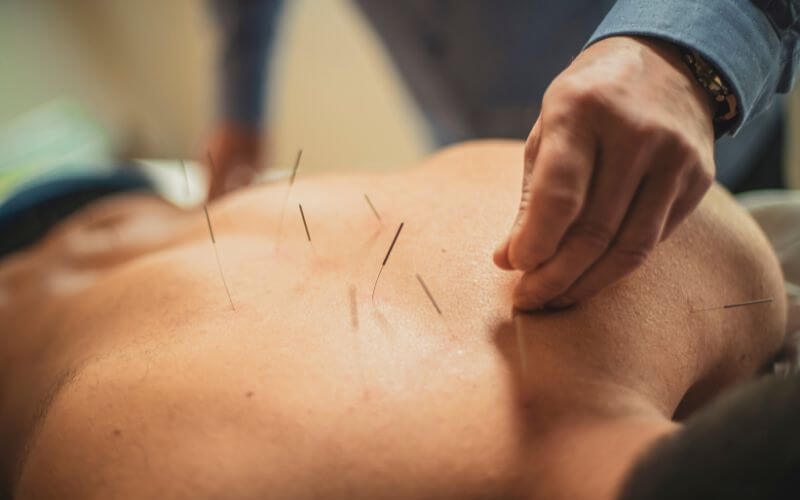 Incorporating Natural Healing Acupuncture into Your Wellness Routine
